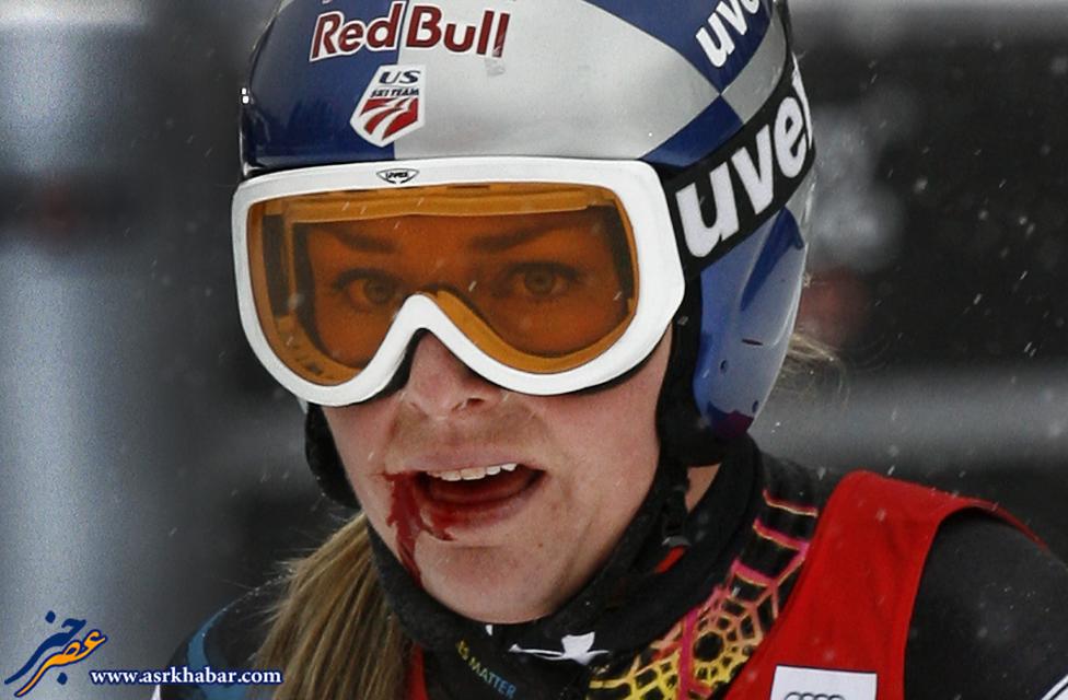 حادثه برای اسکی باز زن (عکس)
