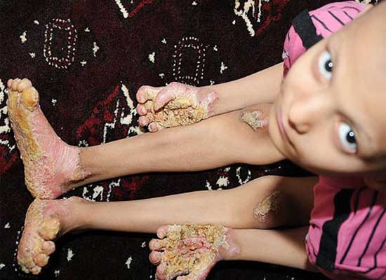 بیماری «محمد امین» درمان ندارد+ عكس