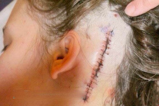 این زن «بیماری خودکشی» دارد! (عکس)