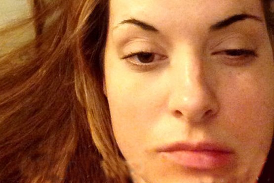 این زن «بیماری خودکشی» دارد! (عکس)