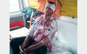 کتک خوردن امدادگر اورژانس از شوهر بیمار