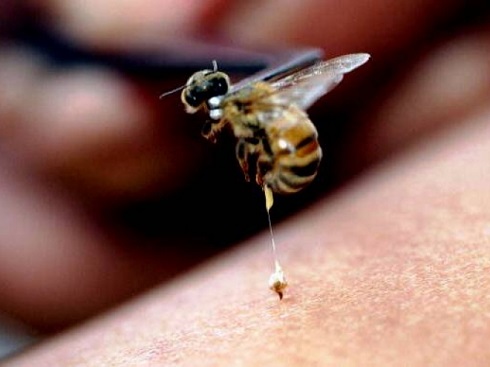 درمان گزیدگی زنبور