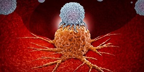 راهی جدید برای درمان سرطان روده