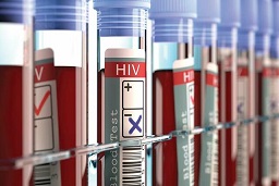 ایدز یکی از 10 عامل تهدید کننده سلامت