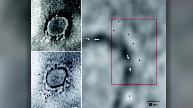 هندی‌ها تصویر میکروسکوپی "کرونا" را منتشر کردند