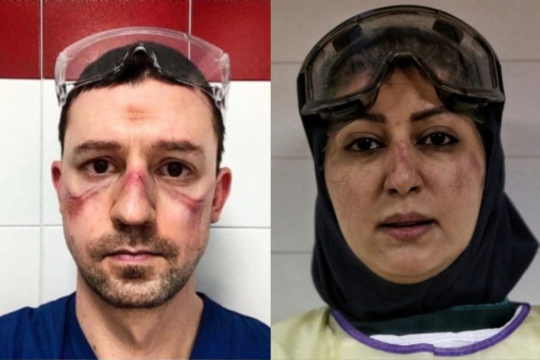 احساساتی که کبودی چهره یک خانم دکتر برانگیخت