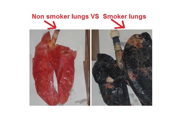 سیگار با ریه چه می کند؛ تغییر باورنکردنی طی 30 سال/ همه چیز درباره دود دست اول تا دست سوم!