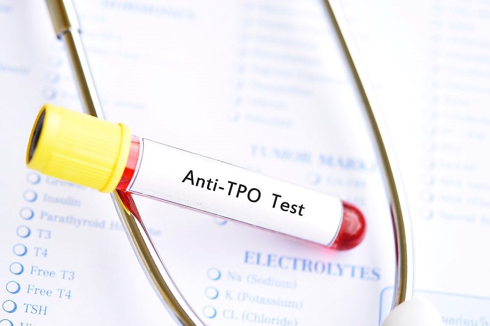 آیا بیماری خود ایمنی با آزمایش Anti TPO مشخص می‌شود؟