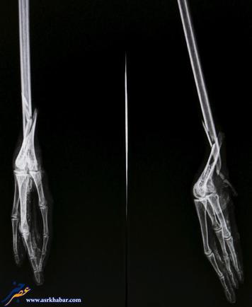 تصاویر جالب از پای مصنوعی یک فلامینگو
