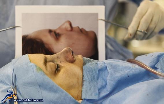 تصاویر رسانه انگلیسی از عمل دماغ در ایران