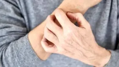 خطاهای رایج پوستی در هوای سرد